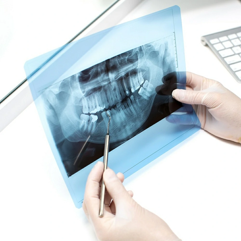 Exams & X-rays