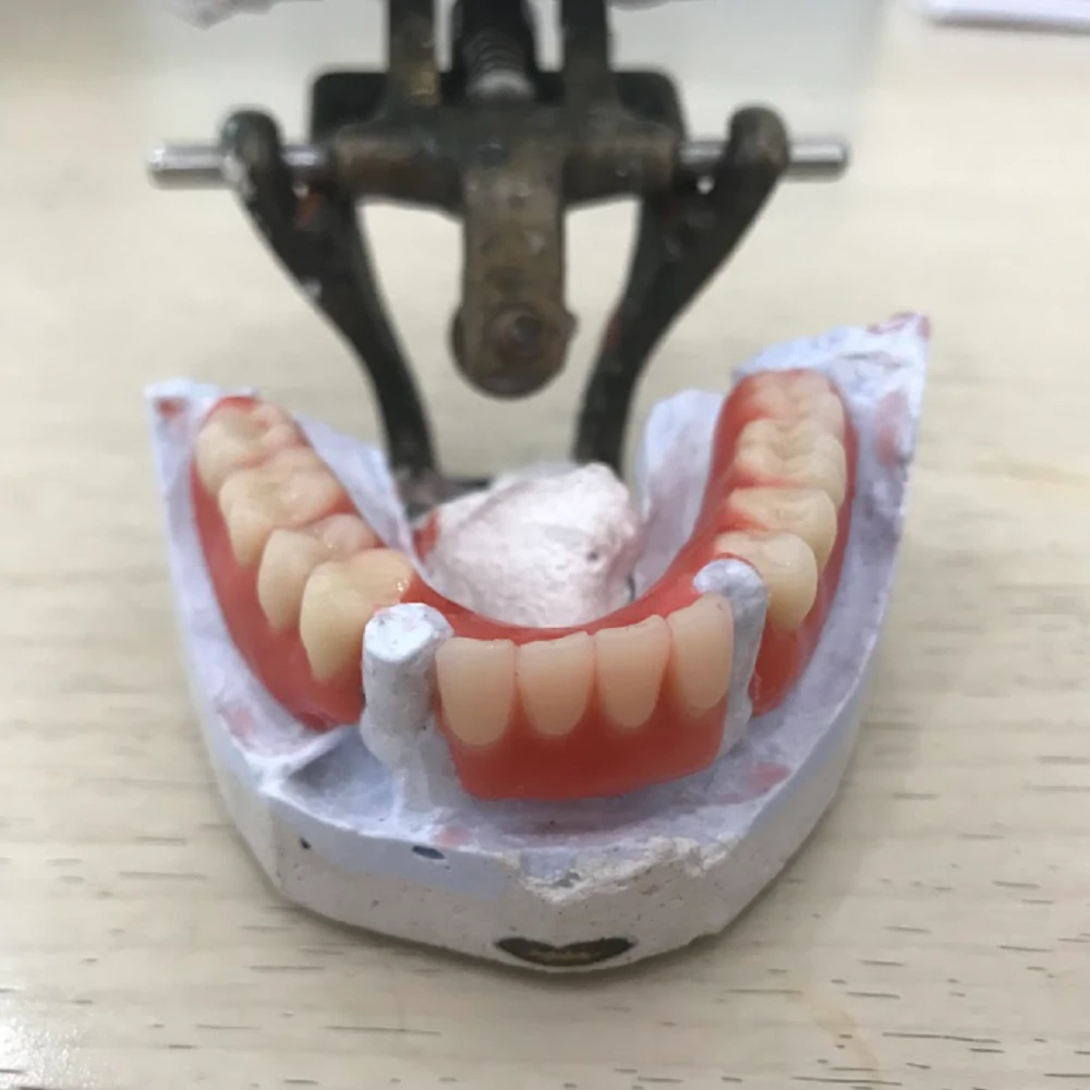 Dentures